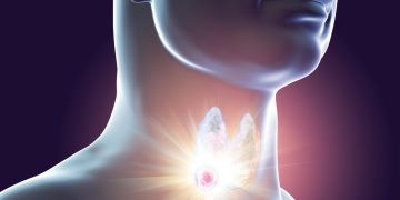 טיפול בבלוטת התריס