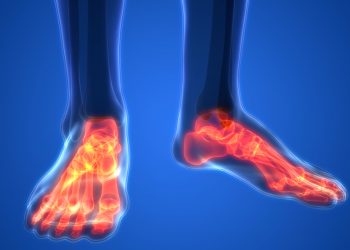 בעיות רגליים והליכה