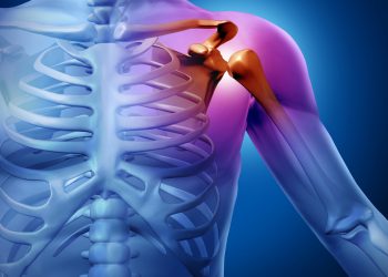 בעיות כתפיים