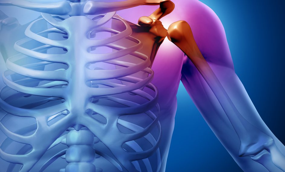 בעיות כתפיים