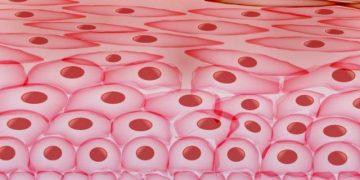 סובלים מפסוריאזיס בעיות עור ניסיתי הכל וכלום לא עזר אורן זריף טיפול פסיכוקינזיס