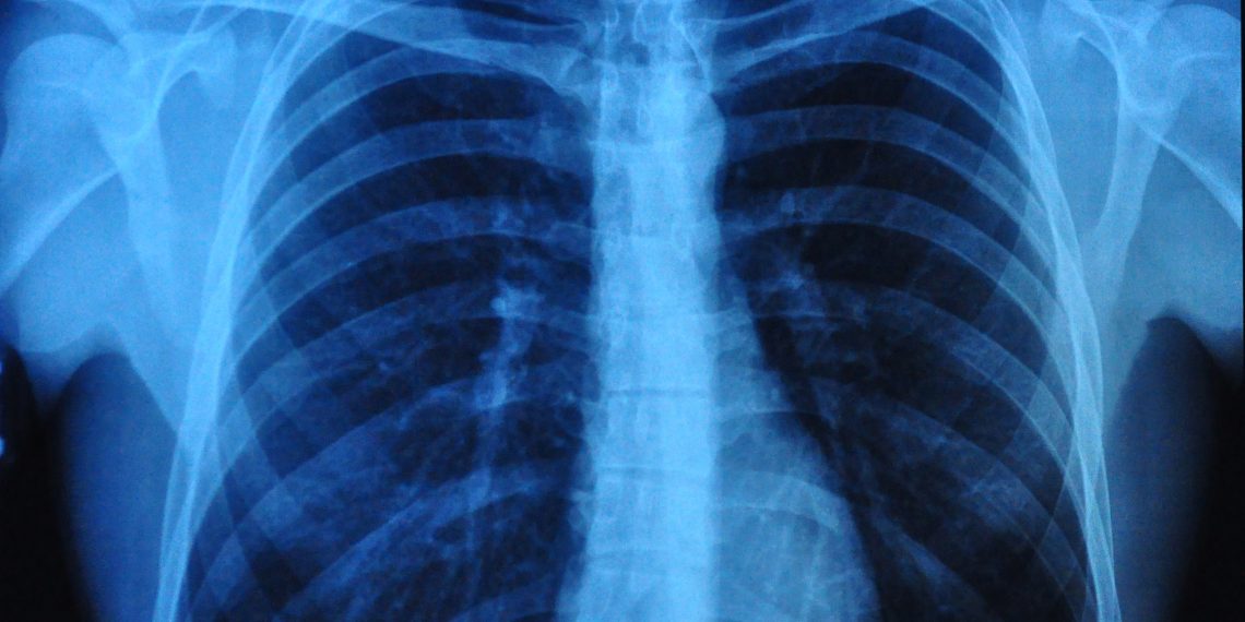 סובלים מבעיות בריאות כל מה שחשוב לדעת