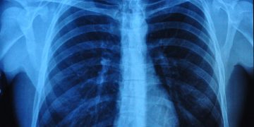 סובלים מבעיות בריאות כל מה שחשוב לדעת