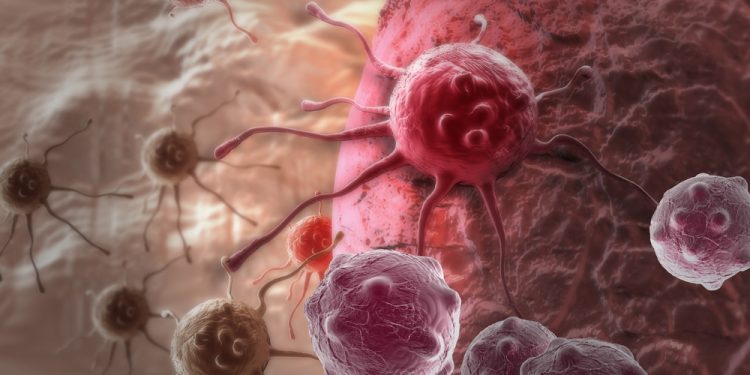 אונקולוגיה