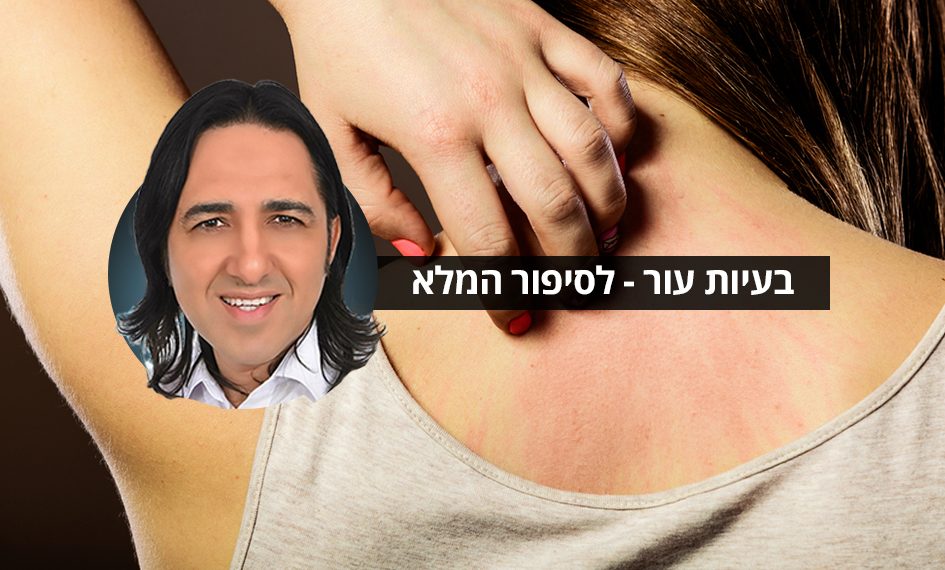 בעיות עור